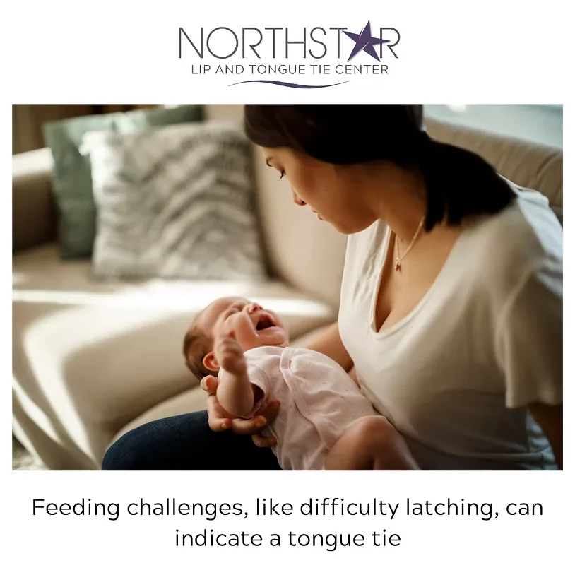 A mother feeding her baby — feeding challenges like difficulty latching can indicate a tongue tie