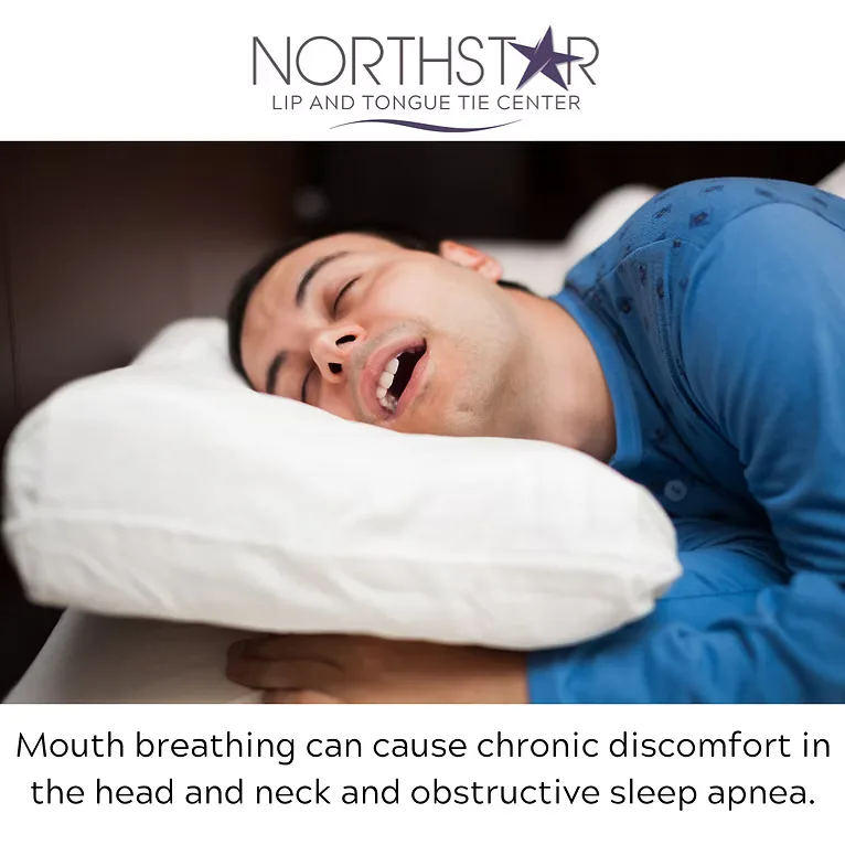 Tongue Ties in Adults: The Hidden Cause of TMJ Pain, Neck Tension, and Mouth Breathing