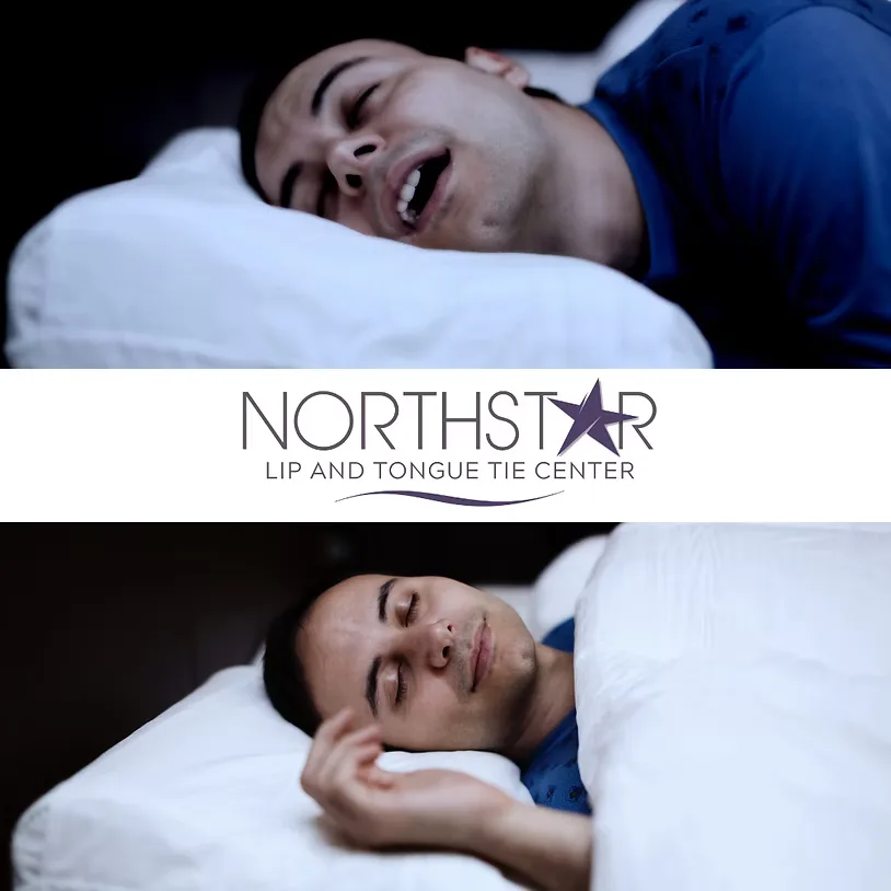 Comparison of a person sleeping with mouth open versus mouth closed