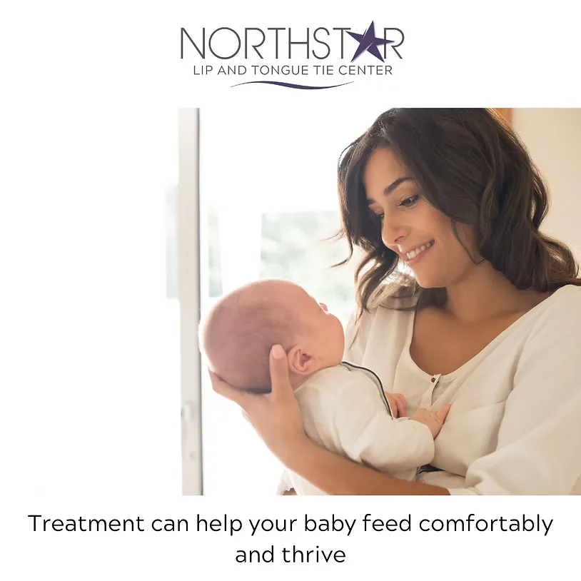 How Do You Know If Your Baby Has a Tongue Tie? A Guide for Parents in Columbus, Ohio